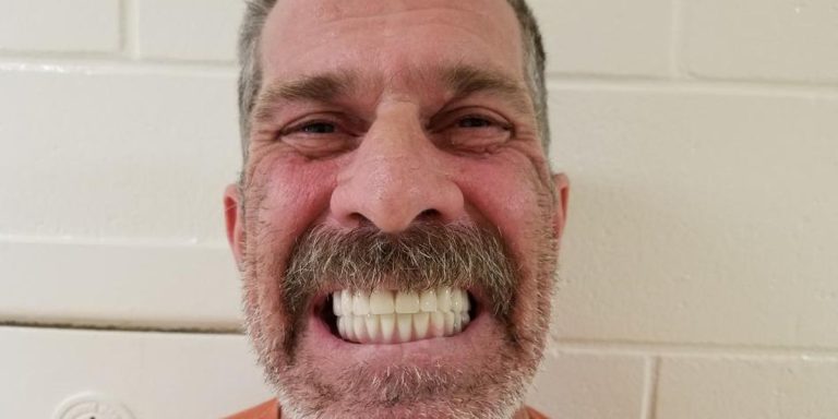 Florida man uses fake ID, steals $41K in dental implants, $10K for French bulldog